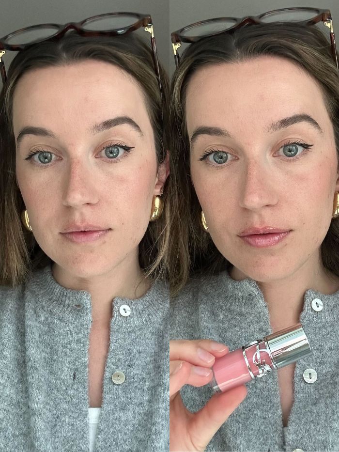 La giovane beauty editor Grace Lindsay prima e dopo aver testato un prodotto volumizzante per le labbra