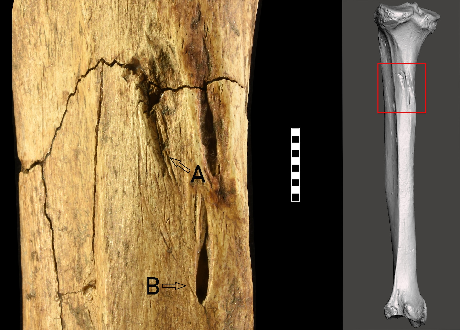 an image of a tibia with a zoomed in inset showing projectile marks and cuts