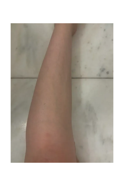 Fashion E-Commerce Editor Julia Marzovilla tests the Braun Silk Expert Pro 5 IPL