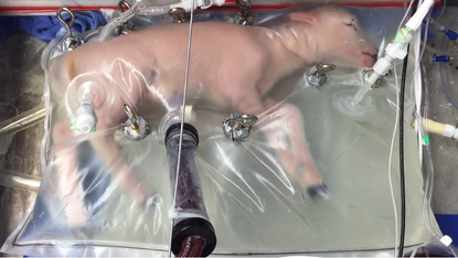 An artificial womb kept a premature lamb alive for months.