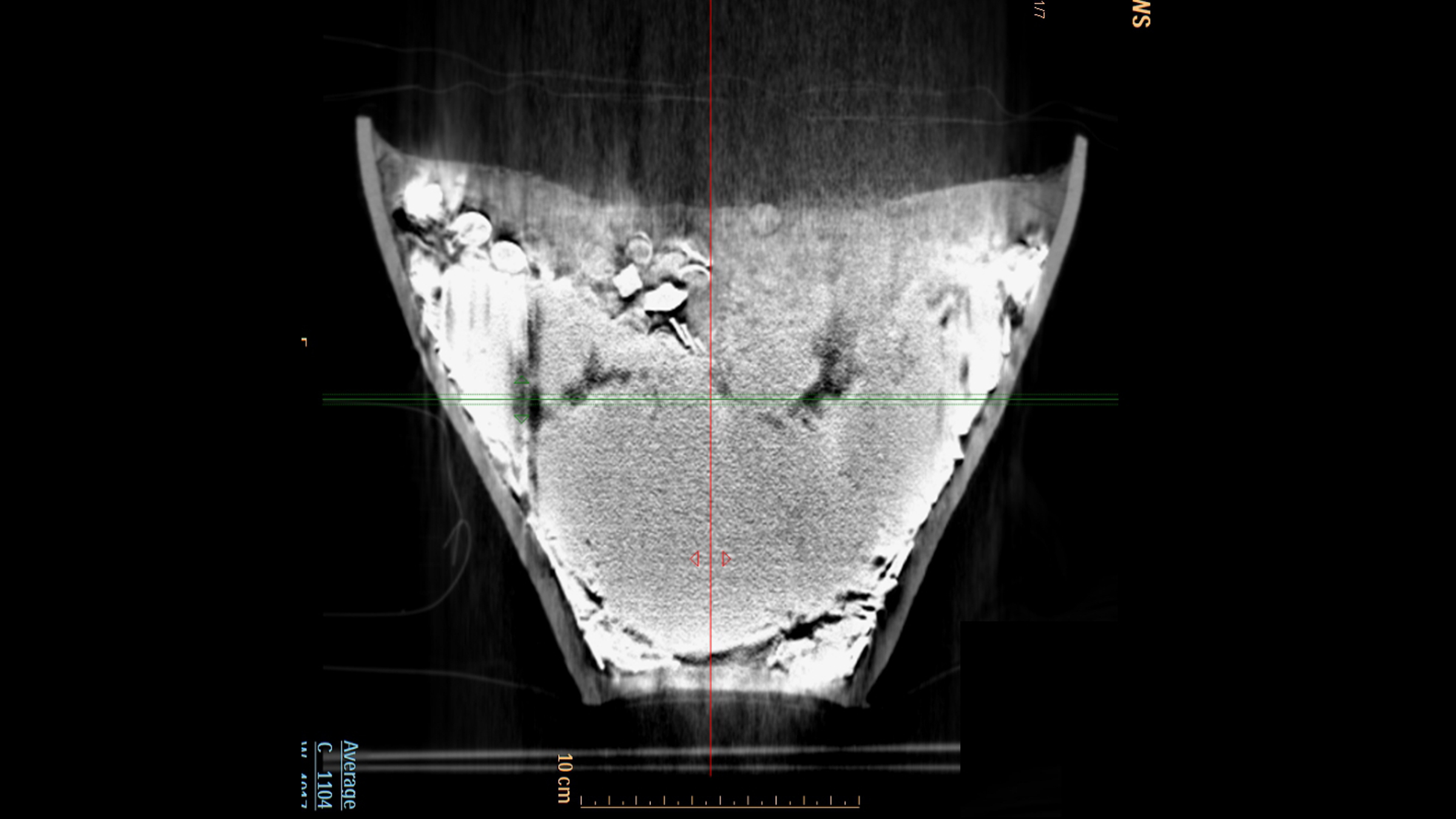 A CT scan of the ceramic vessel, which holds the medieval hoard.