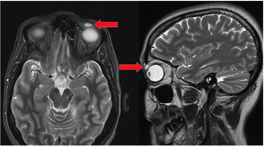 bmj case report, brain scan