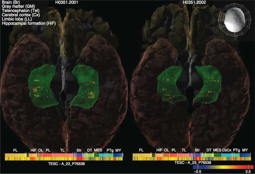 Specific Genes Linked to Big Brains and Intelligence | Live Science