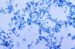 Valley Fever Fungus Invades The Brain In 3 Rare Cases Live - 