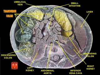 Transverse view of the colon and other internal organs.
