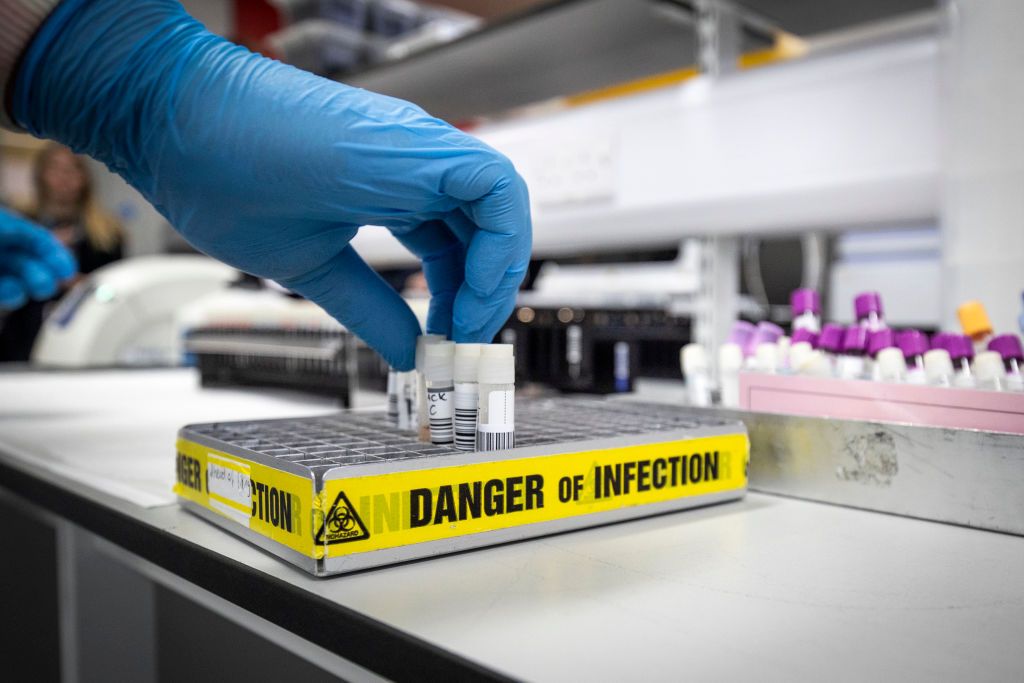 Clinical support technician Douglas Condie extracts viruses from swab samples