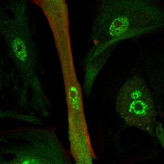 Heart muscle cell made by transfering RNA