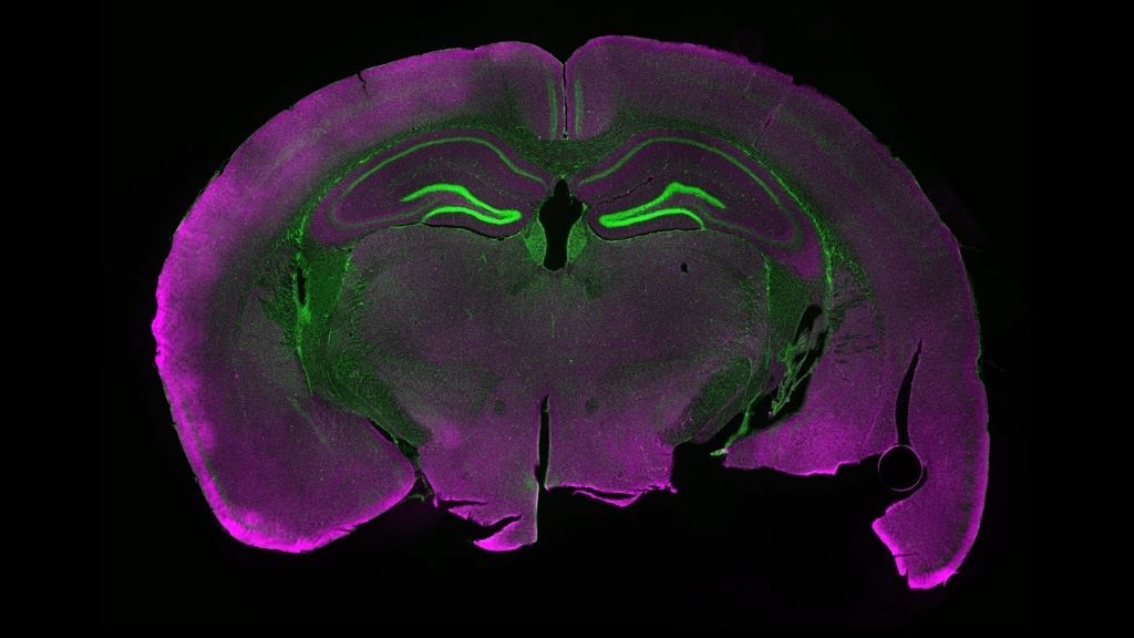 microscopy image of a fluorescently labeled section of a mouse brain.