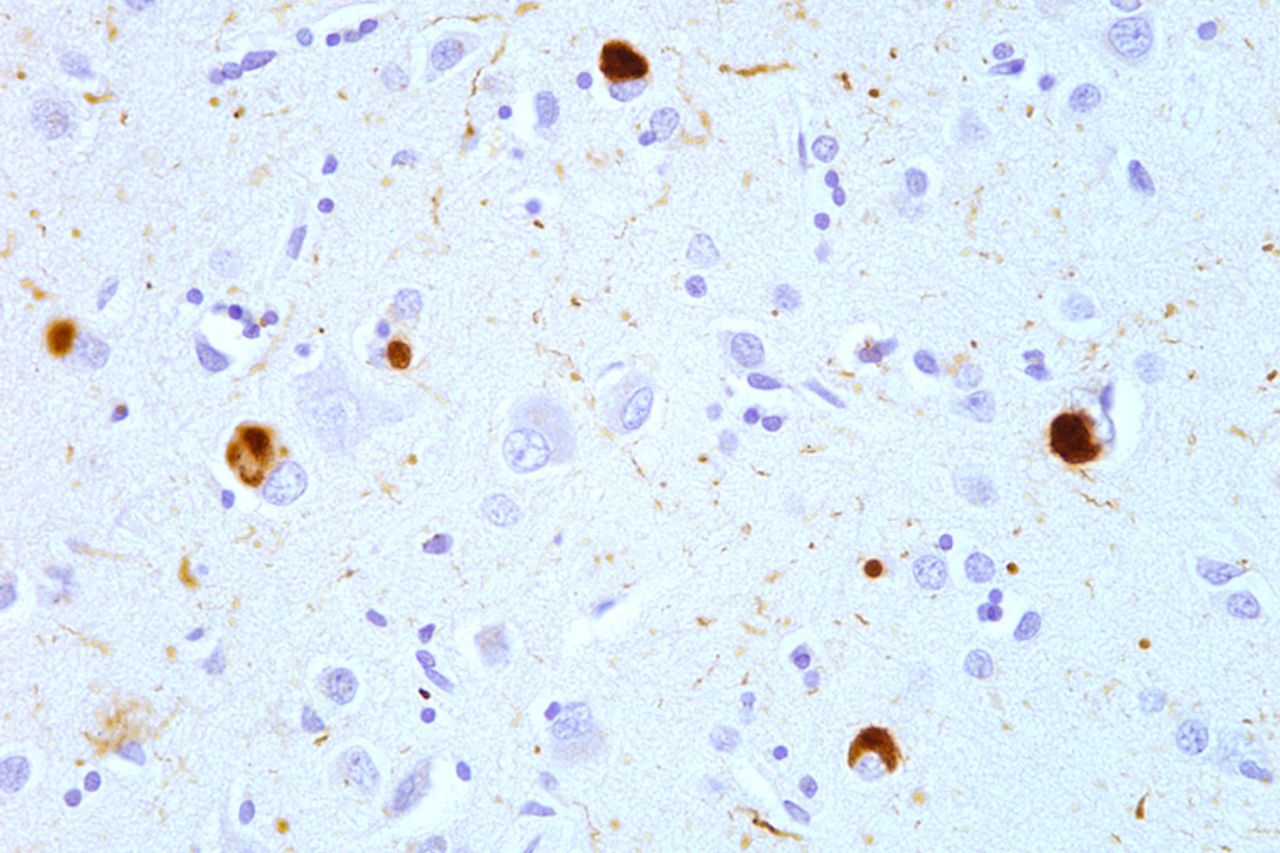 A microscope image showing brown dots around cells