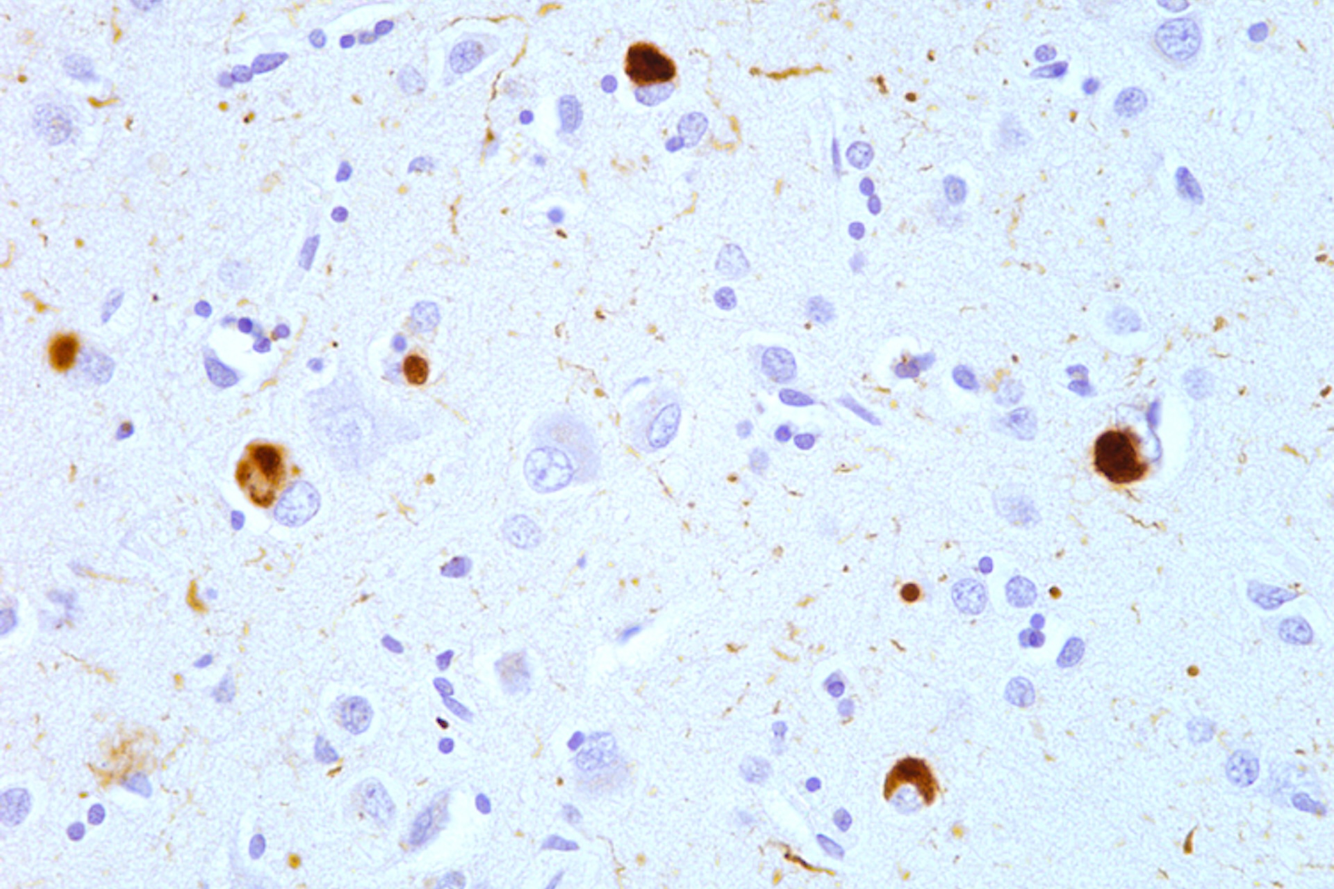 A microscope image showing brown dots around cells