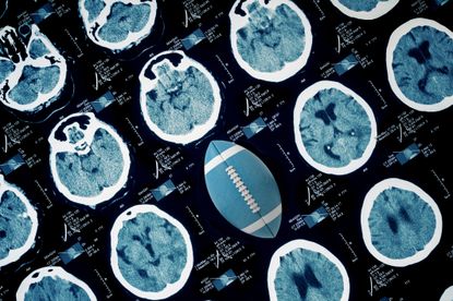 Football among brain scans.
