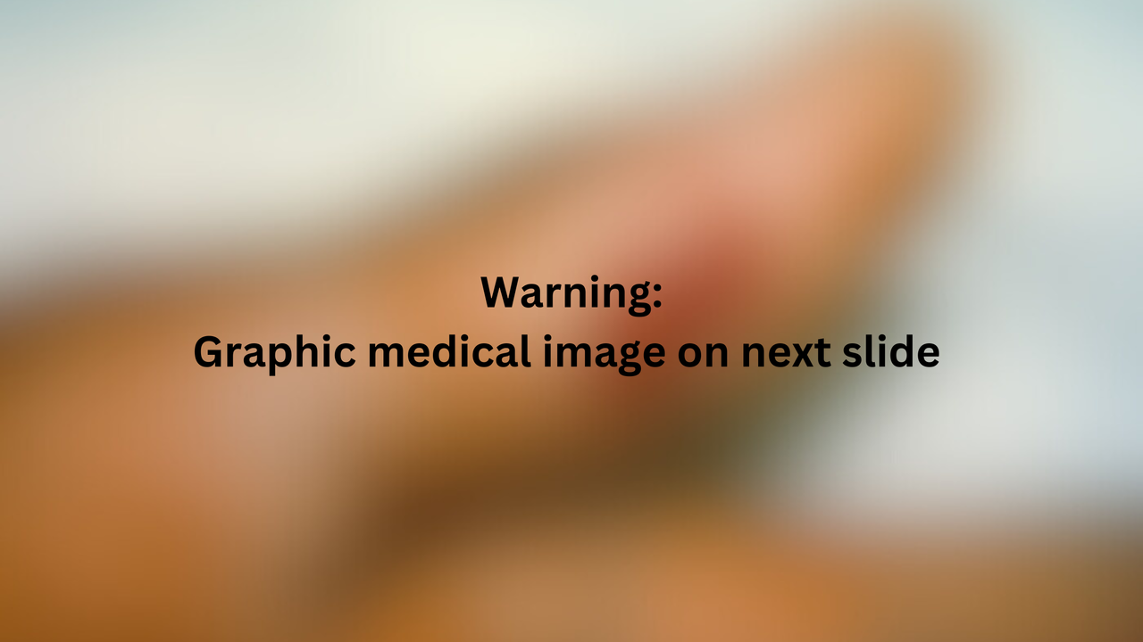 Blurred image with text in black which reads "Warning: Graphic medical image on next slide"