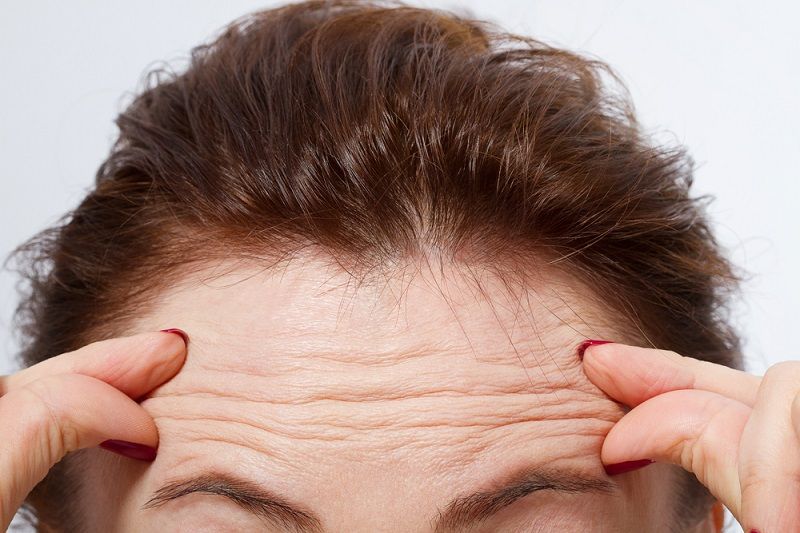 wrinkles-causes-and-treatment