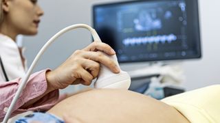 A pregnant woman receives an ultrasound