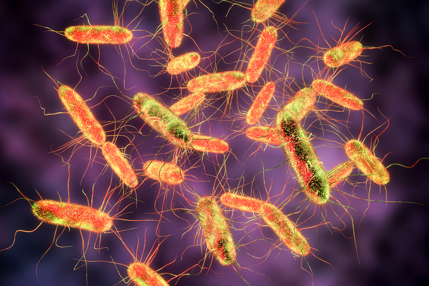 Salmonella osteomyelitis 