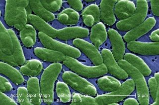 A scanning electron micrograph image of Vibrio vulnificus bacteria.