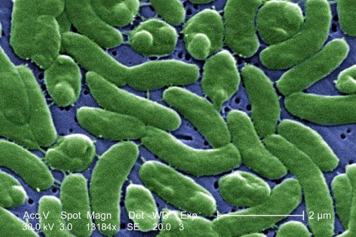 A scanning electron micrograph image of Vibrio vulnificus bacteria.