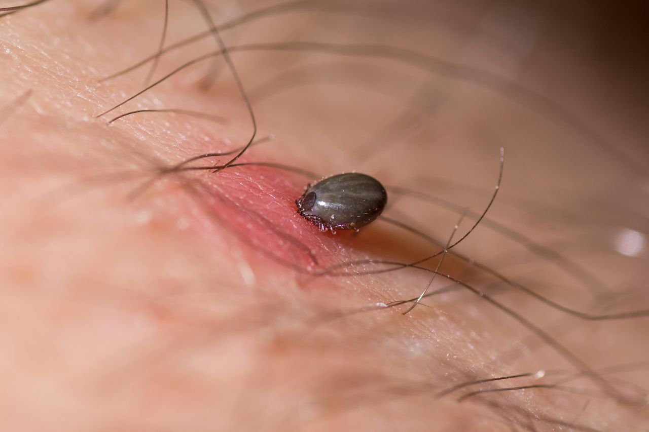 A nymph sheep tick (Ixodes ricinus) swollen with blood after feeding for 36 hours.