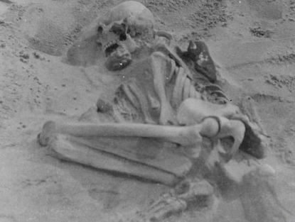 Neolithic skeleton bears evidence of Rickets disease.