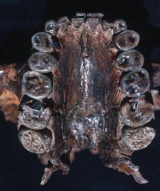 This image shows the palate and maxillary teeth of Paranthropus boisei, also called Nutcracker Man.