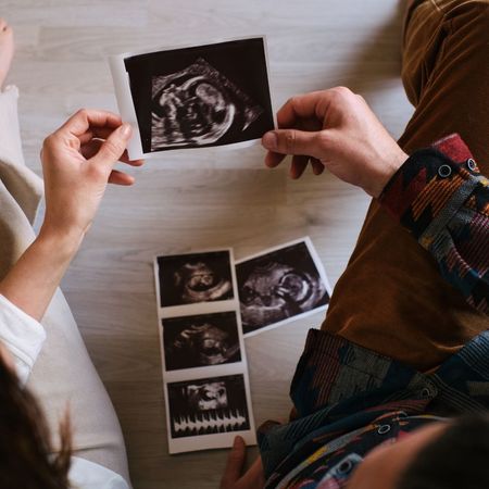 A husband and wife with a baby scan image