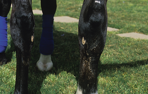 1-Lymphangitis-SwollenLeg1.jpg