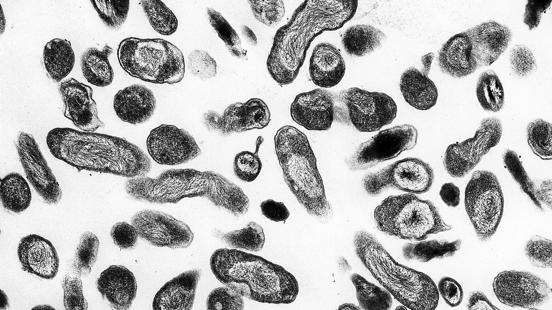 Black and white image of Coxiella burnetii bacteria; the cells appear round or oval-shaped with a dark membrane and lighter insides