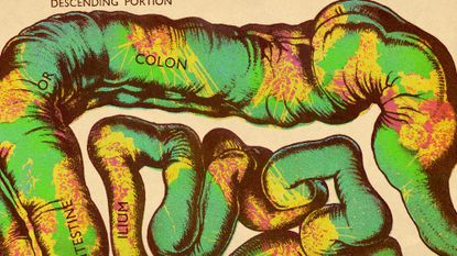 Illustrative collage of a vintage diagram of the bowels and colon, overlaid with a macro photograph of colon cancer cells.
