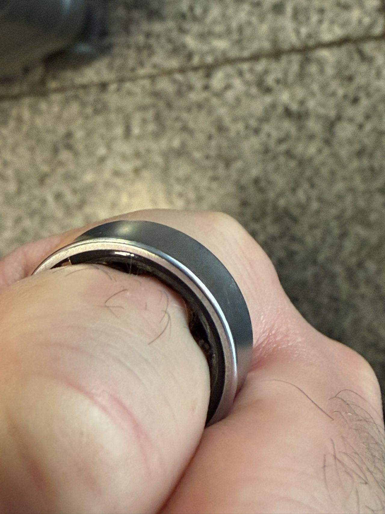Swollen Samsung Galaxy Ring on the finger of Daniel Rotar