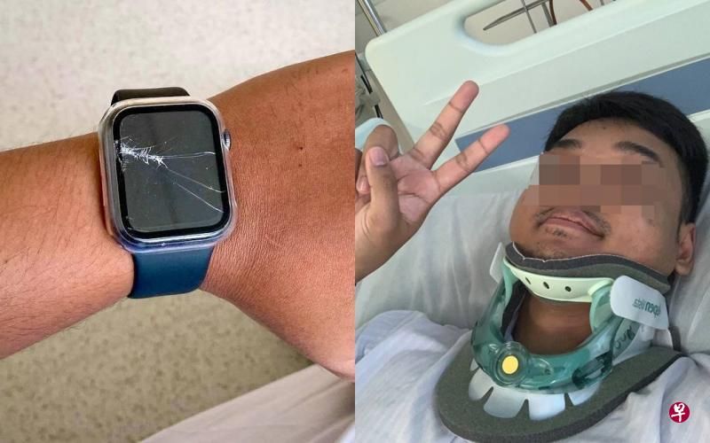 Broken Bike Fall Apple Watch