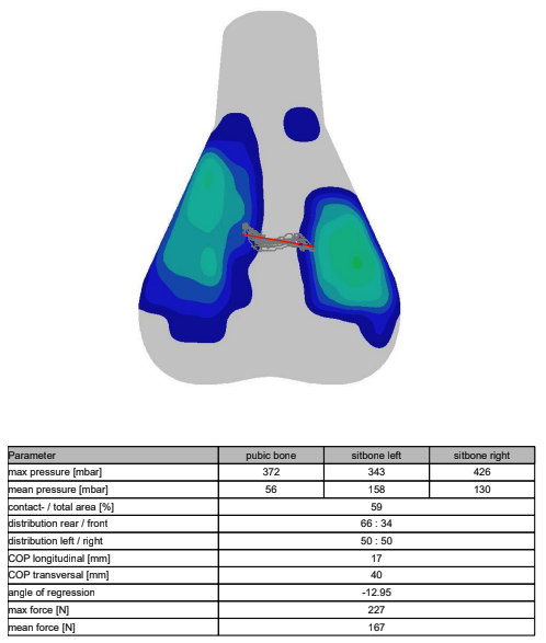 A visual output of saddle pressure mapping