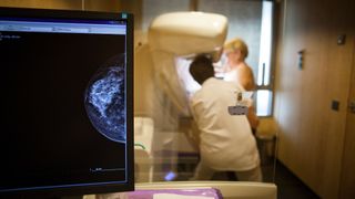 in the foreground, there's a computer screen showing a mammogram. Blurred in the background, we can see a medical provider in a white coat assisting a patient at a mammogram machine