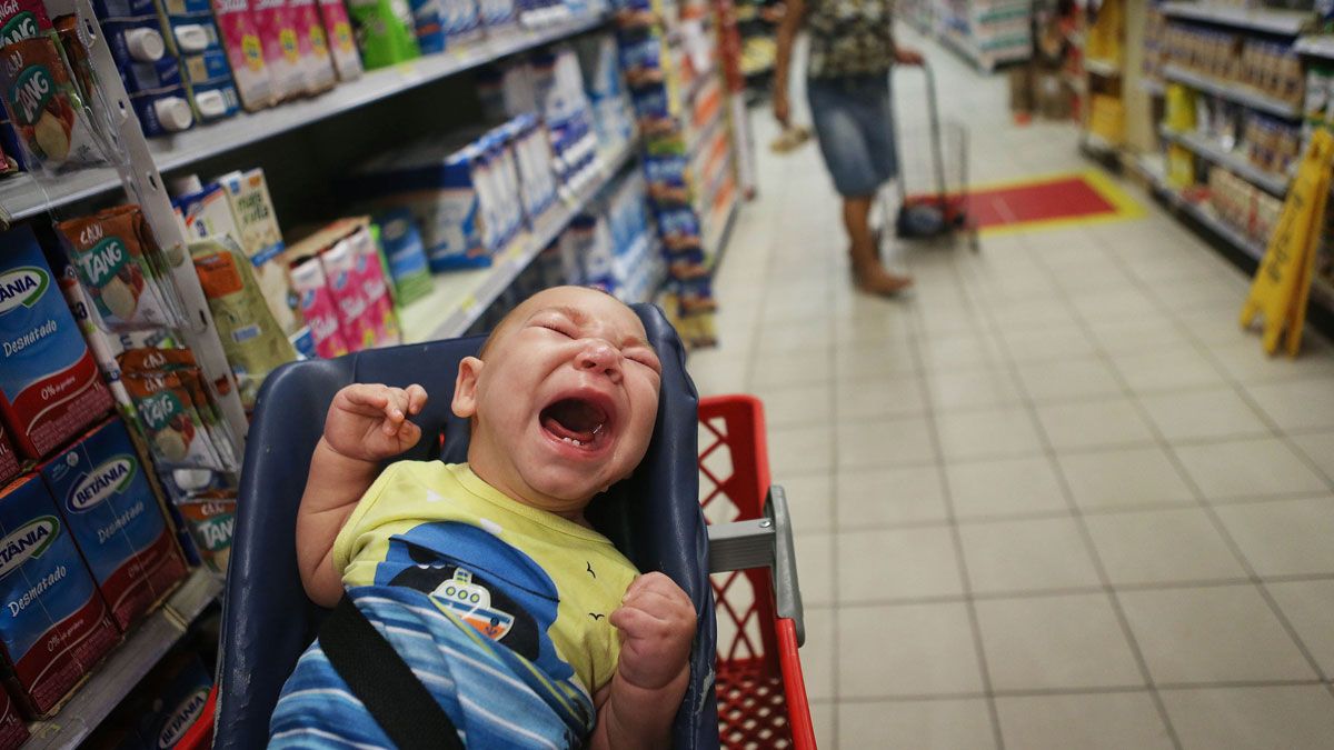 microcephaly zika