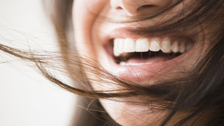 woman laughing with straight white teeth