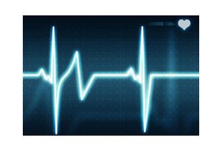 How To Make Sense Of Heart Rate Data Live Science