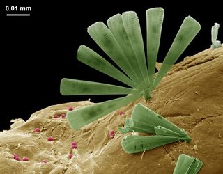 Diatoms and bacteria on ocean plastic