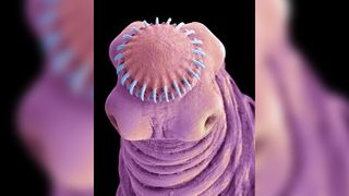 Scanning electron micrograph (SEM) of the head of the cysticercus stage of the pork tapeworm (Taenia solium).