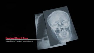 How to take the X-Rays in Silent Hill Townfall