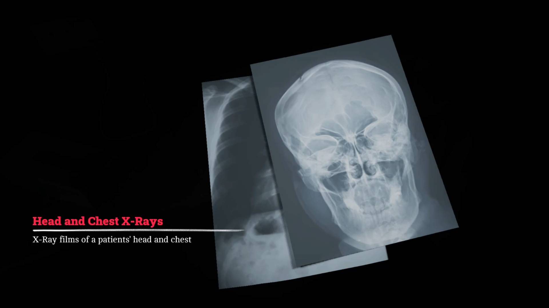 Silent Hill Townfall x-ray puzzle