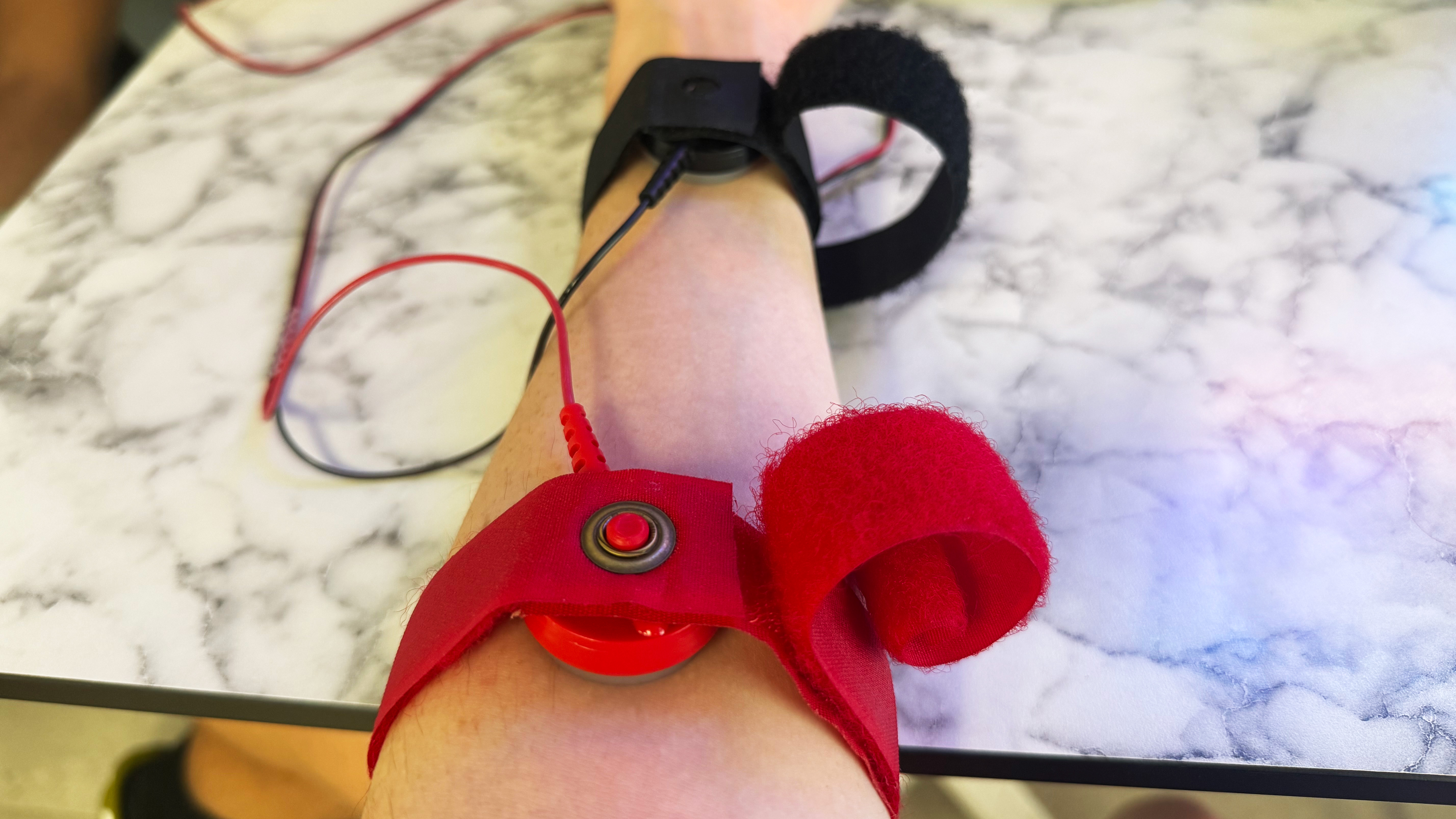 a photo of a black and red electrode on skin to stimulate sweat glands