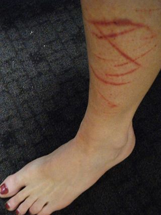 Leg scratches, courtesy of the nasty, prickly Australian bush!