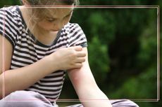 A young girl scratching her arm where there is evidence of one of the common types of insect bites in the UK