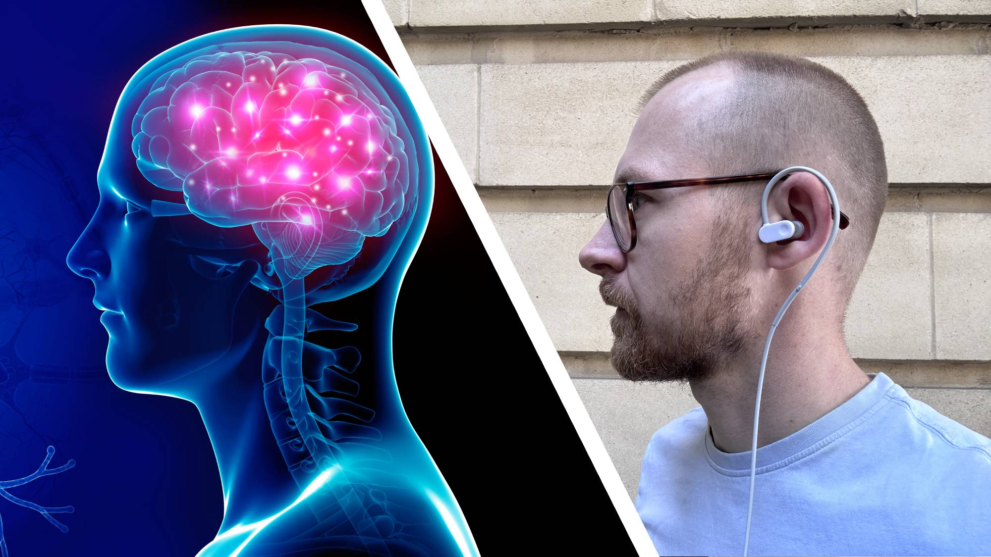 Stock image of brain activity juxtaposed with caucasian man wearing Nurosym 