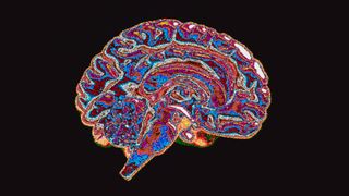 Cross section of the brain