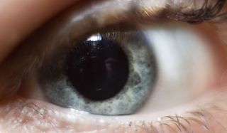 7 Bizarre Eye Conditions