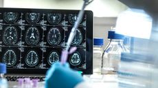 Image shows a scientist adding a sample to a test tube in front of computer monitor showing images of brain scans