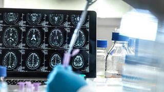 Image shows a scientist adding a sample to a test tube in front of computer monitor showing images of brain scans