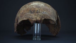 The skull of the hunter-gatherer, who has been dubbed RV 2039. 