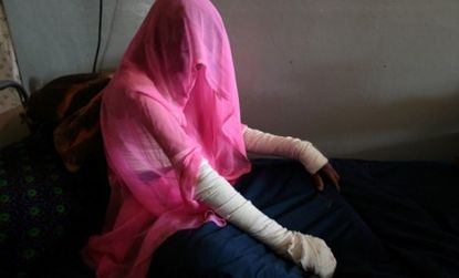 Afghanistan's Ministry of Women's Affairs reported that at least 103 women set themselves on fire between March 2009 and March 2010. 