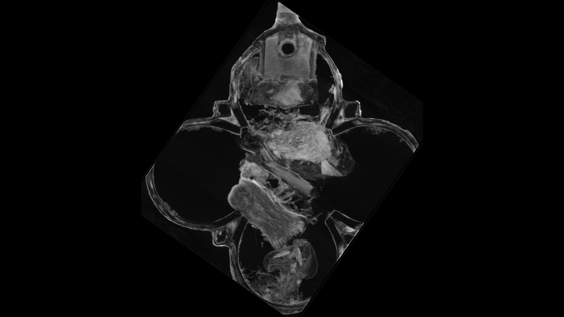 Para peneliti berharap pencitraan tomografi neutron lebih lanjut akan mengungkap selembar perkamen atau kertas di dalam liontin, dengan huruf yang dapat mereka baca untuk menunjukkan dari santo mana tulang itu berasal.